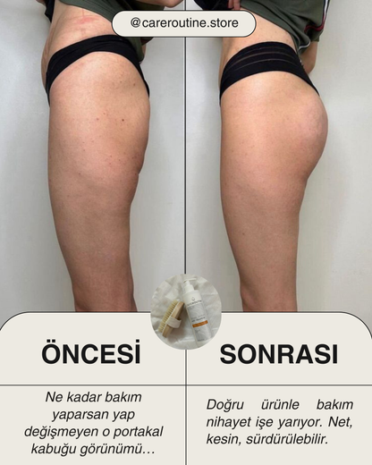 CareRoutine - LOCCİS™ Anti-Selülit Jel